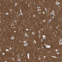 Anti-STXBP1 antibody produced in rabbit HPA008209-100UL
