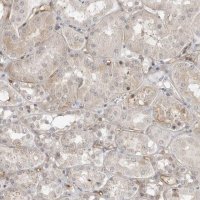 Anti-STXBP3 antibody produced in rabbit HPA027225-100UL
