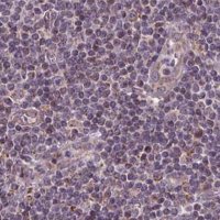 Anti-SUCLA2 antibody produced in rabbit 