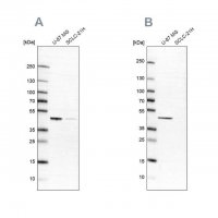 Anti-SUCLG2 antibody produced in rabbit 