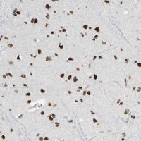 Anti-SUFU antibody produced in rabbit HPA008700-100UL