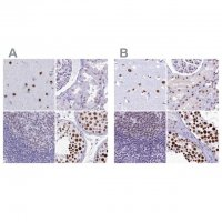 Anti-SUGP2 antibody produced in rabbit 