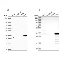 Anti-SULT2A1 antibody produced in rabbit 