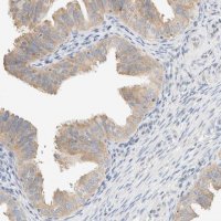 Anti-SUMF2 antibody produced in rabbit 