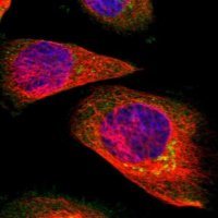 Anti-SUN3 antibody produced in rabbit 