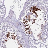 Anti-SUN5 antibody produced in rabbit 