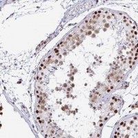 Anti-SUPT16H antibody produced in rabbit 