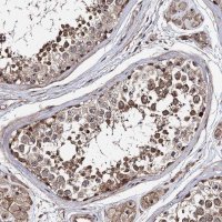 Anti-SUPT20H antibody produced in rabbit 