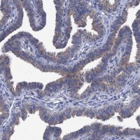 Anti-SVEP1 antibody produced in rabbit 