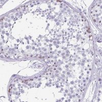 Anti-SYCP1 antibody produced in rabbit 