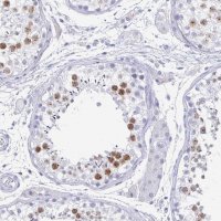 Anti-SYCP3 antibody produced in rabbit 