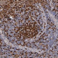 Anti-SYK antibody produced in rabbit 