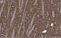 Anti-Synaptophysin Antibody, clone 1G7, ZooMAb Rabbit Monoclonal 