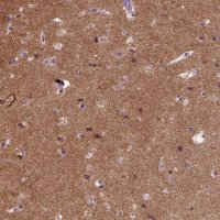 Anti-SYNGAP1 antibody produced in rabbit 