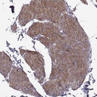 Anti-SYNPO2 antibody produced in rabbit 