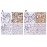 Anti-SYNPR antibody produced in rabbit 