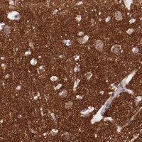 Anti-SYP antibody produced in rabbit 
