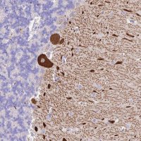 Anti-TAC3 antibody produced in rabbit 