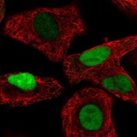 Anti-TALDO1 antibody produced in rabbit HPA048089-100UL