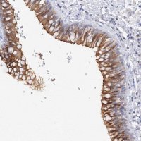 Anti-TAMM41 antibody produced in rabbit 