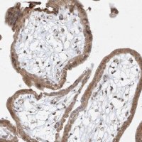 Anti-TASP1 antibody produced in rabbit 