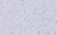 Anti-Tau Antibody, clone 3D20 ZooMAb Rabbit Monoclonal 