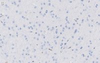 Anti-Tau-1 Antibody, clone PC1C6 ZooMAb Mouse Monoclonal 