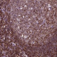 Anti-TBC1D10C antibody produced in rabbit 
