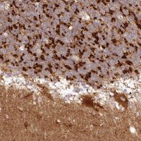 Anti-TBC1D14 antibody produced in rabbit 