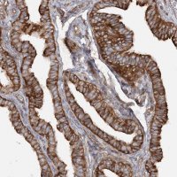 Anti-TBC1D5 antibody produced in rabbit 