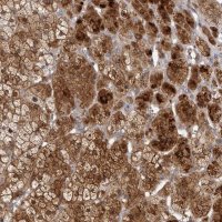 Anti-TBC1D8B antibody produced in rabbit 
