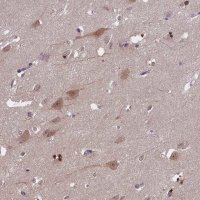 Anti-TBCB antibody produced in rabbit 