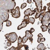 Anti-TBCE antibody produced in rabbit 