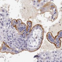 Anti-TCEANC antibody produced in rabbit 