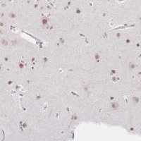 Anti-TCERG1 antibody produced in rabbit 
