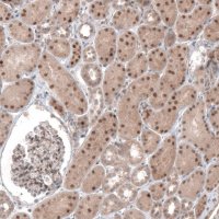 Anti-TCF21 antibody produced in rabbit 