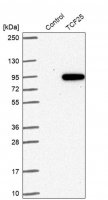 Anti-TCF25 antibody produced in rabbit HPA041699-100UL
