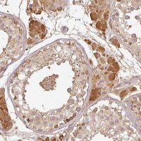 Anti-TCL1B antibody produced in rabbit 