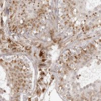 Anti-TCTEX1D1 antibody produced in rabbit 