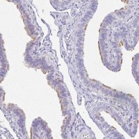Anti-TCTEX1D4 antibody produced in rabbit 