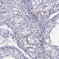 Anti-TDRD1 antibody produced in rabbit 
