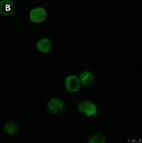 Anti-Tec Antibody, clone 19M23, ZooMAb Rabbit Monoclonal 
