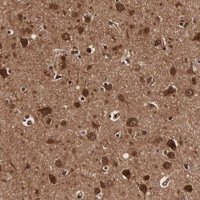 Anti-TECPR2 antibody produced in rabbit 