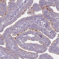 Anti-TEKT4 antibody produced in rabbit 
