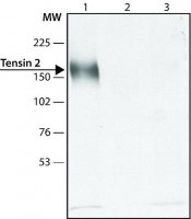 Anti-Tensin 2 (C-terminal) antibody produced in rabbit 