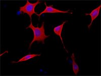 Anti-Tensin 2 (N-terminal) antibody produced in rabbit 
