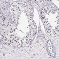 Anti-TEPP antibody produced in rabbit 