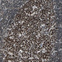 Anti-TERF2IP antibody produced in rabbit 