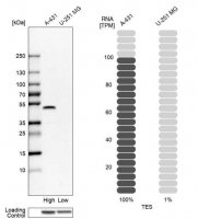 Anti-TES antibody produced in rabbit 