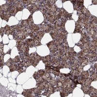 Anti-TESC antibody produced in rabbit 